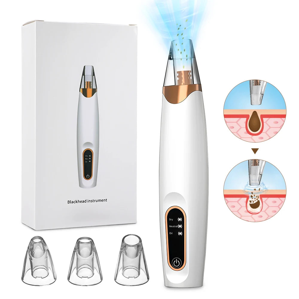 Blackhead Remover – Diepe Reiniging & Gladde Huid