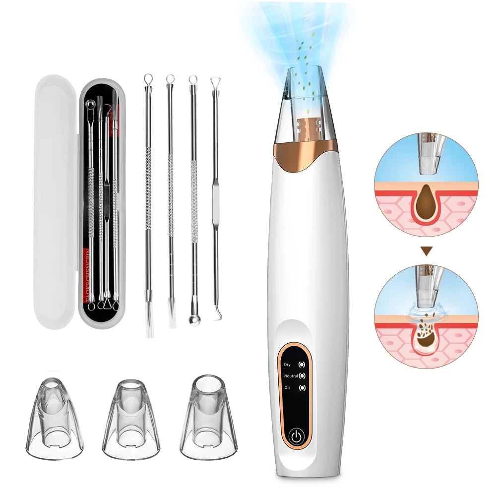 Blackhead Remover – Diepe Reiniging & Gladde Huid