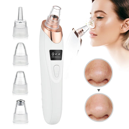 Blackhead Remover – Diepe Reiniging & Gladde Huid