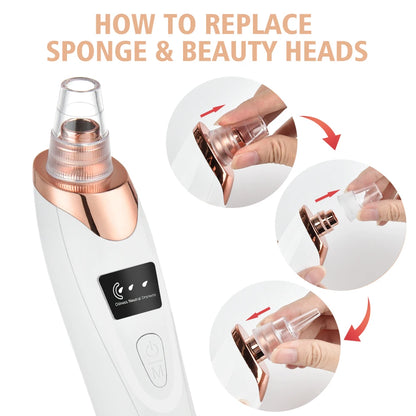 Blackhead Remover – Diepe Reiniging & Gladde Huid